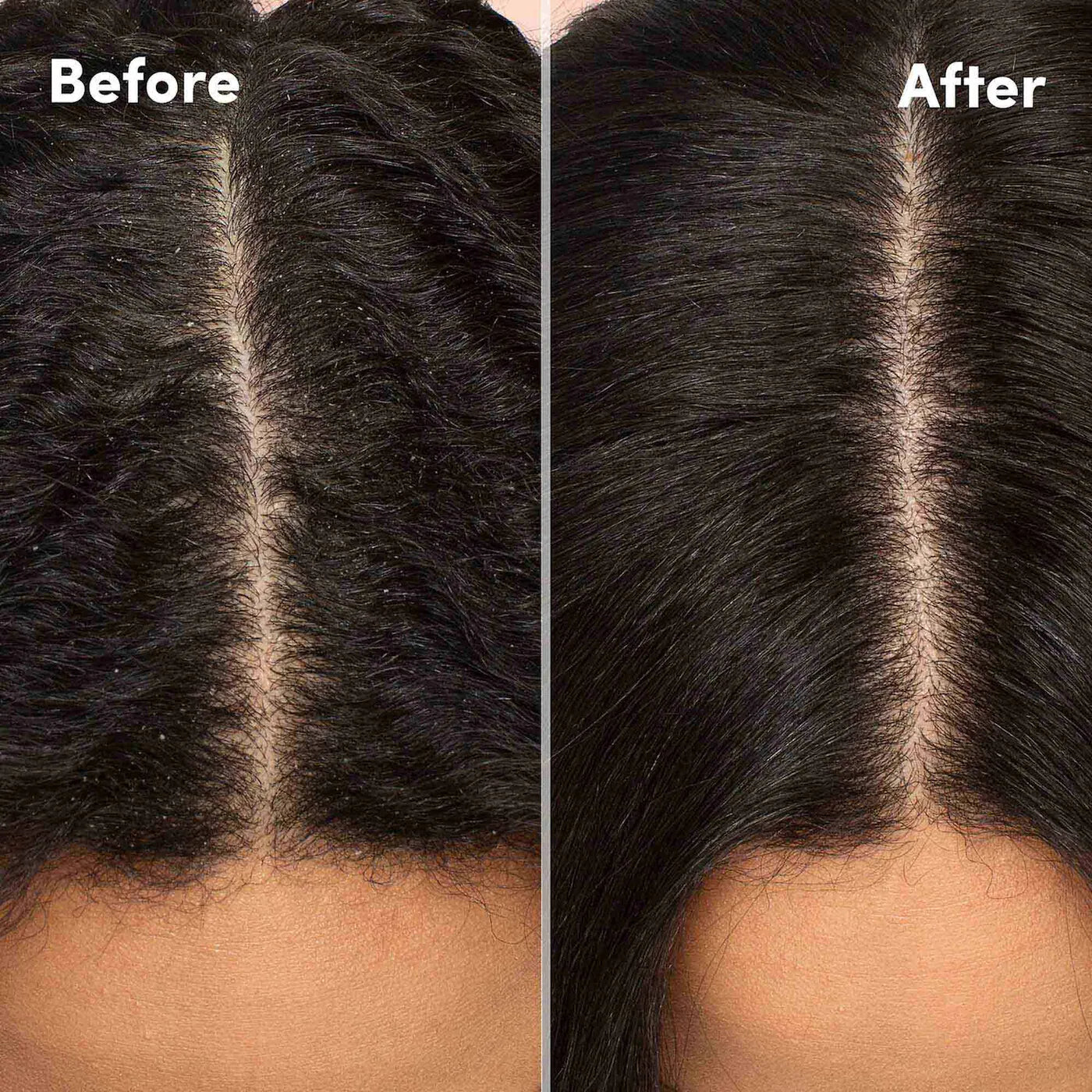 Shampoo anticaspa/resequedad Mizanie